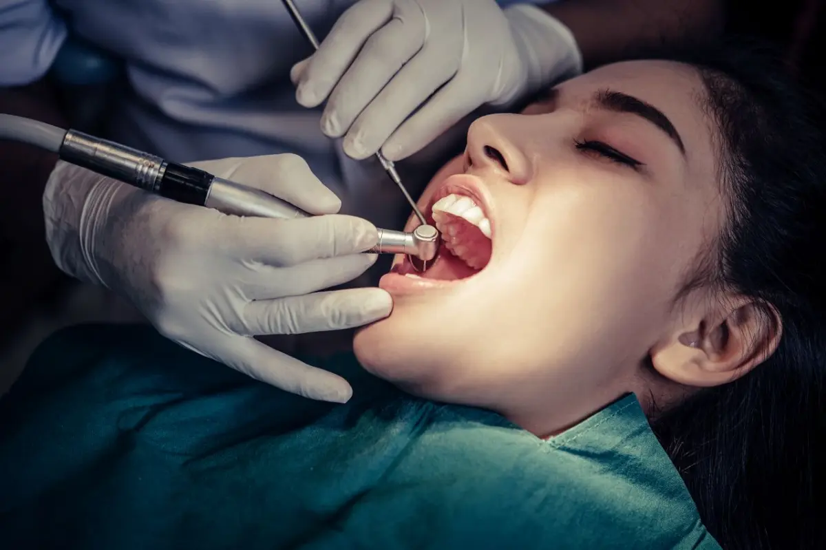 Dental fillings